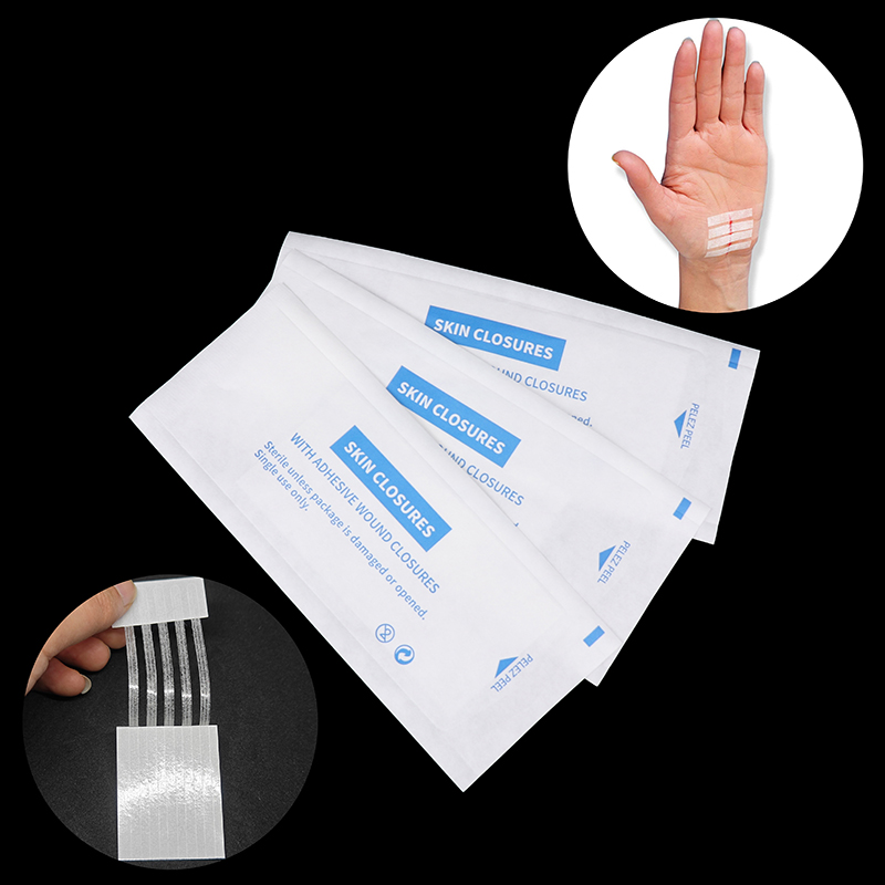 Medical Label - ที่กำจัดรอยแผลเป็นจากสิวฆ่าเชื้อเครื่องมือฉุกเฉินที่ปิดแผลสำหรับเดินทางที่ปิดผิวหนังกาวทางการแพทย์สำหรับผ่าตัด